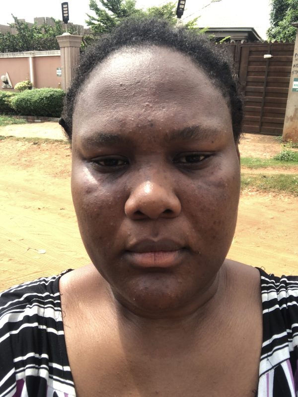 Chioma Rosemary Egbuonu
