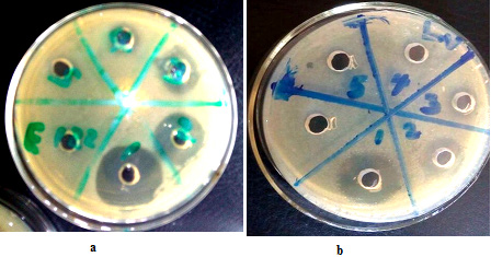 Synergistic Interaction of Natural Snail Mucin and Lincomycin for Immuno-chemotherapy against Streptopneumococcal Infection: Checkerboard Evaluations - International Journal of Pharmaceutical Investigation